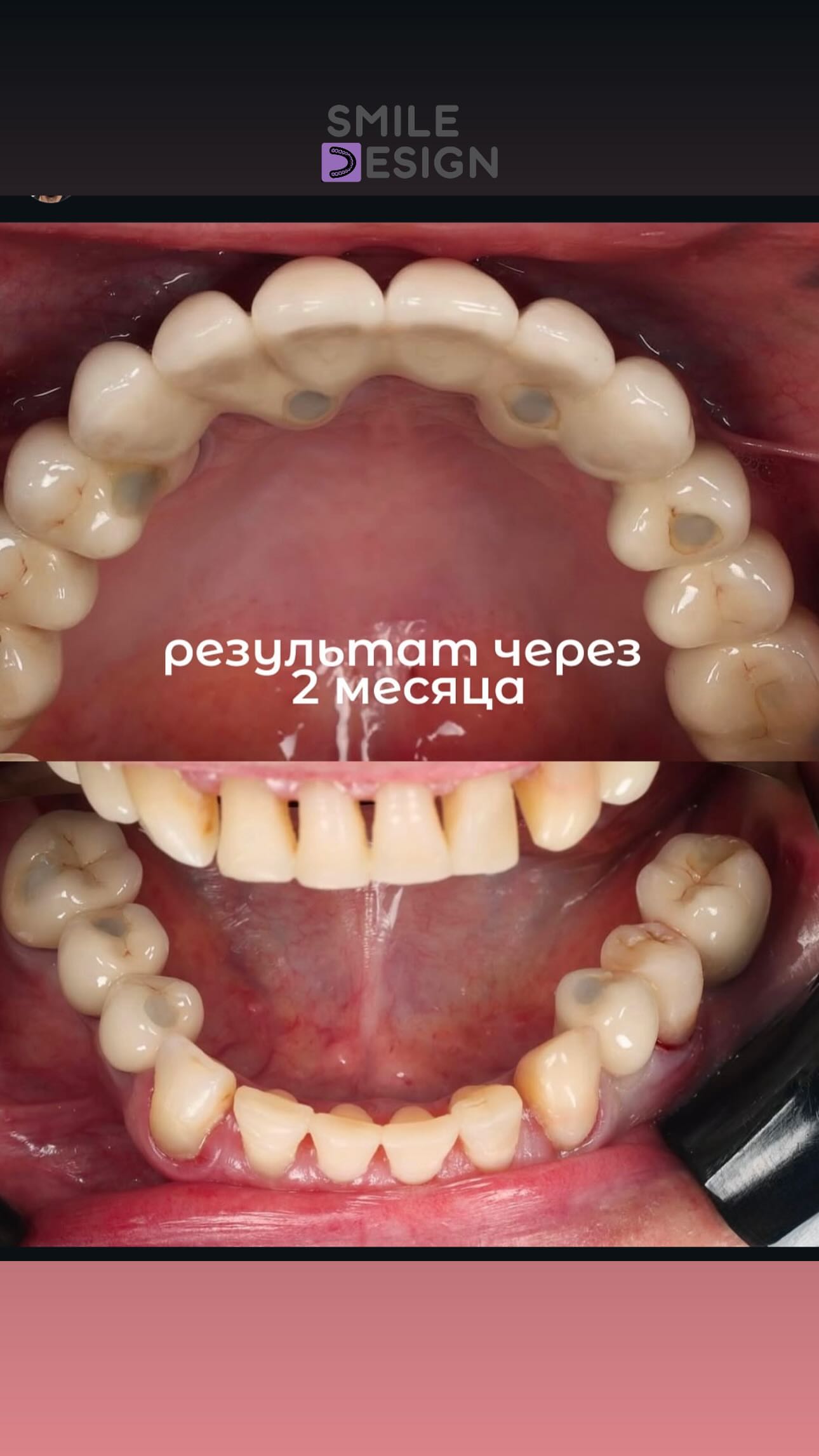 Dr. Даниэль — результат